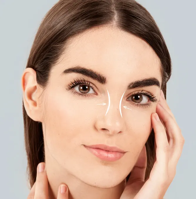 تجميل الأنف في إيران