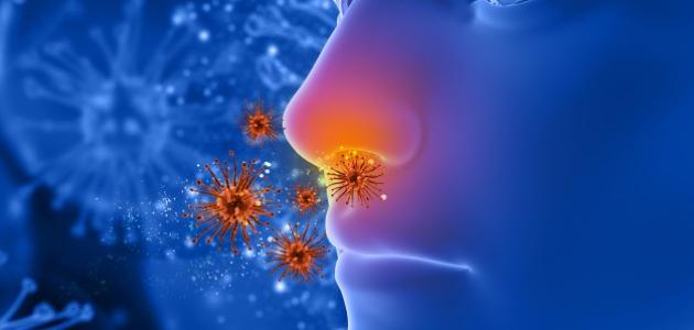 الأنفلونزا