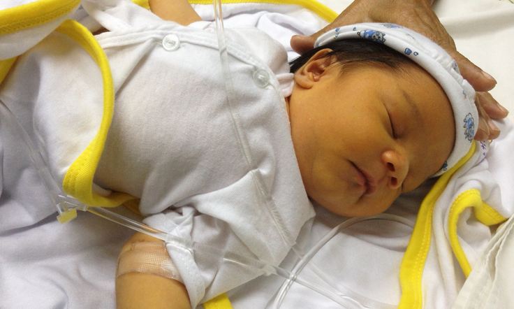 اليرقان عند الأطفال