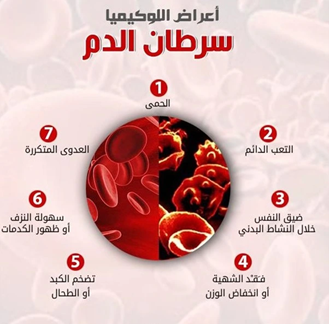 علاج أنواع سرطان الدم في إيران