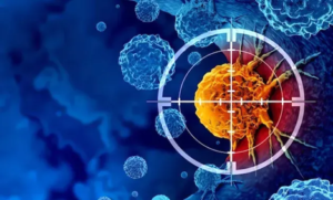 علاج السرطان في إیران 