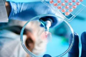 علاج السرطان في إیران 