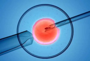 أفضل الحلول لعلاج العقم والتلقيح الصناعي