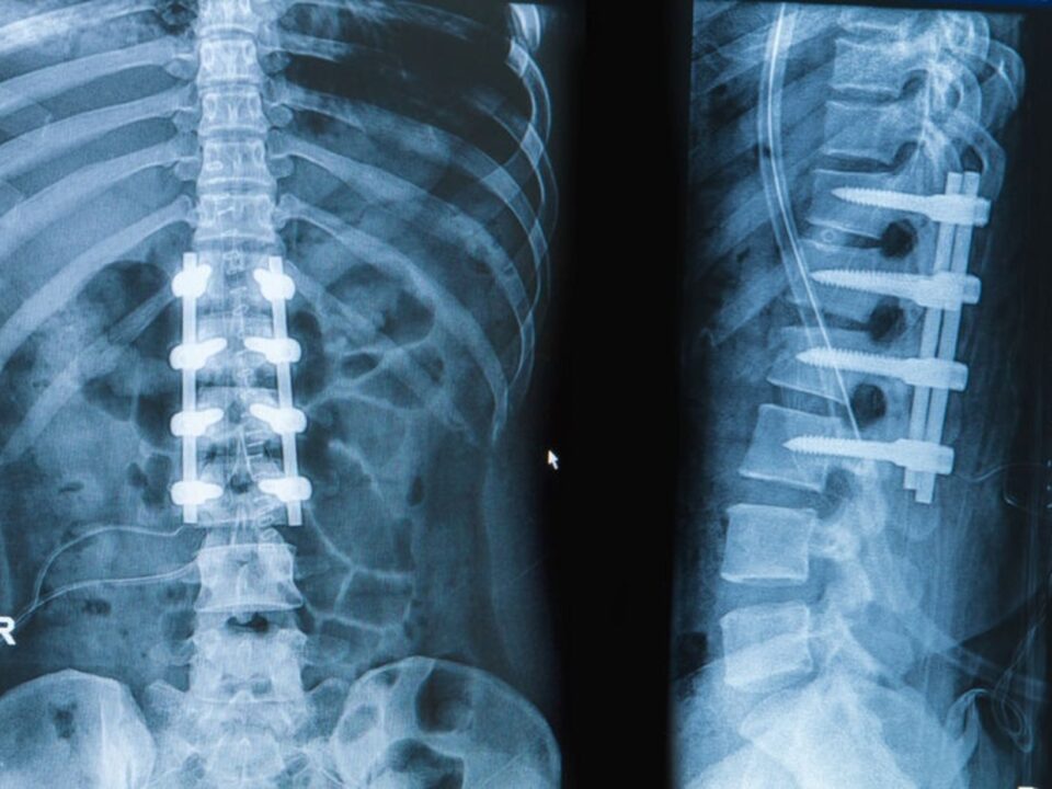 الخدمات الطبية للمرضى الدوليين في إيران