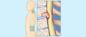 الخدمات الطبية للمرضى الدوليين في إيران
