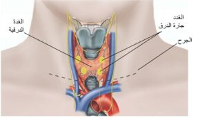 علاج مشاكل الغدة الدرقية في إيران 