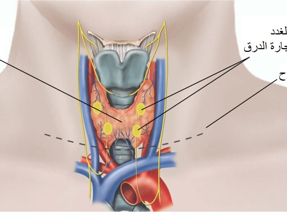 علاج مشاكل الغدة الدرقية في إيران