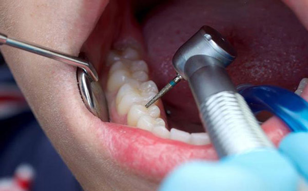 كل ما يجب معرفته عن تنظيف الجير